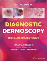 کتاب Diagnostic Dermoscopy: The Illustrated Guide