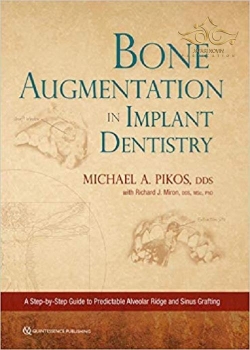کتاب Bone Augmentation in Implant Dentistry