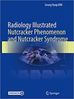 کتاب Radiology Illustrated: Nutcracker Phenomenon and Nutcracker Syndrome