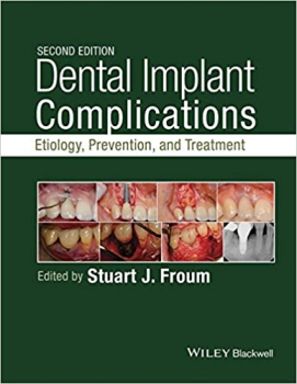 خرید اینترنتی کتاب Dental Implant Complications: Etiology, Prevention, and Treatment 2nd Edition