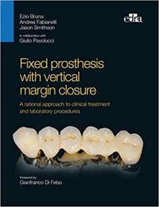 خرید اینترنتی کتاب Fixed prosthesis with vertical margin closure