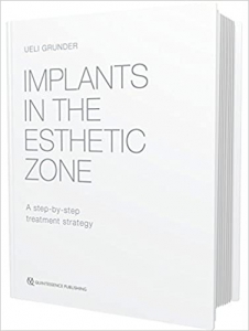 خرید اینترنتی کتاب Implants in the Esthetic Zone: A Step-by-Step Treatment Strategy 1st Edition