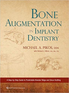 خرید اینترنتی کتاب Bone Augmentation in Implant Dentistry 1st Edition