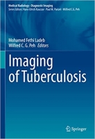 کتاب Imaging of Tuberculosis (Medical Radiology)
