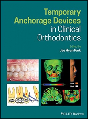 خرید اینترنتی کتاب Temporary Anchorage Devices in Clinical Orthodontics 1st Edition