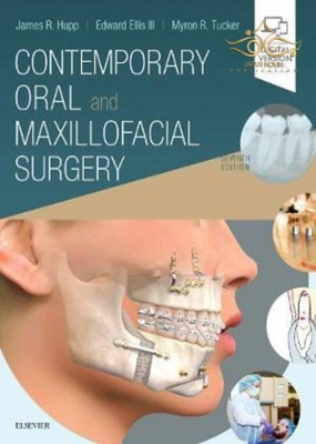 کتاب Contemporary Oral and Maxillofacial Surgery