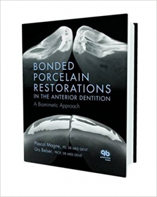خرید اینترنتی کتاب Bonded Porcelain Restorations in the Anterior Dentition: A Biomimetic Approach 1st Edition