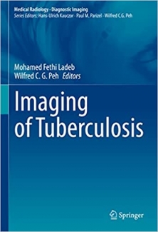 کتاب Imaging of Tuberculosis (Medical Radiology)