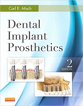 خرید اینترنتی کتاب Dental Implant Prosthetics 2nd Edition
