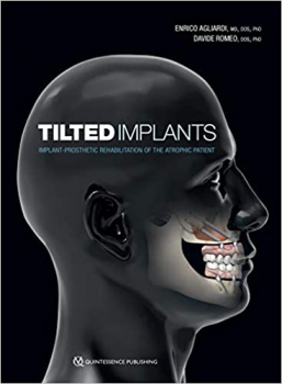 خرید اینترنتی کتاب Tilted Implants: Implant-Prosthetic Rehabilitation of the Atrophic Patient 1st Edition