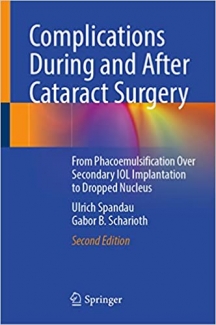 کتاب Complications During and After Cataract Surgery: From Phacoemulsification Over Secondary IOL Implantation to Dropped Nucleus