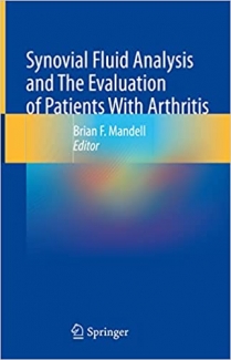 کتاب Synovial Fluid Analysis and The Evaluation of Patients With Arthritis