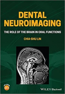 کتاب Dental Neuroimaging: The Role of the Brain in Oral Functions