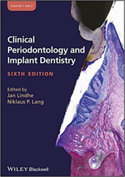 خرید اینترنتی کتاب Clinical Periodontology and Implant Dentistry, 2 Volume Set 6th Edition