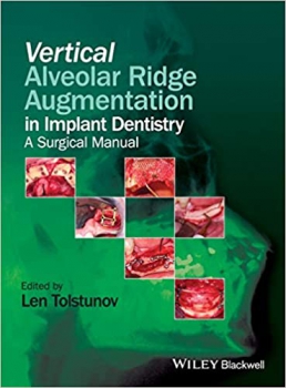 خرید اینترنتی کتاب Vertical Alveolar Ridge Augmentation in Implant Dentistry: A Surgical Manual 1st Edition