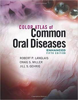 خرید اینترنتی کتاب Color Atlas of Common Oral Diseases, Enhanced Edition 5th Edition