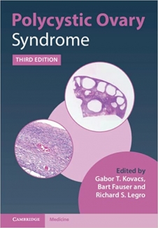 کتاب Polycystic Ovary Syndrome