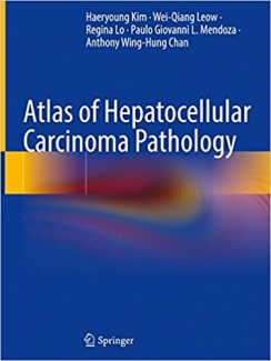 کتاب Atlas of Hepatocellular Carcinoma Pathology