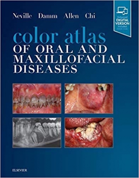 خرید اینترنتی کتاب Color Atlas of Oral and Maxillofacial Diseases 1st Edition