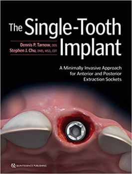 خرید اینترنتی کتاب The Single-Tooth Implant: A Minimally Invasive Approach for Anterior and Posterior Extraction Sockets 1st Edition