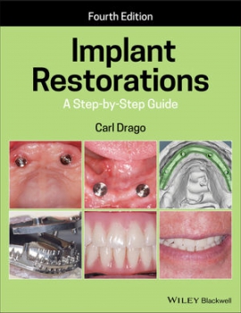 خرید اینترنتی کتاب Implant Restorations: A Step-by-Step Guide 4th Edition
